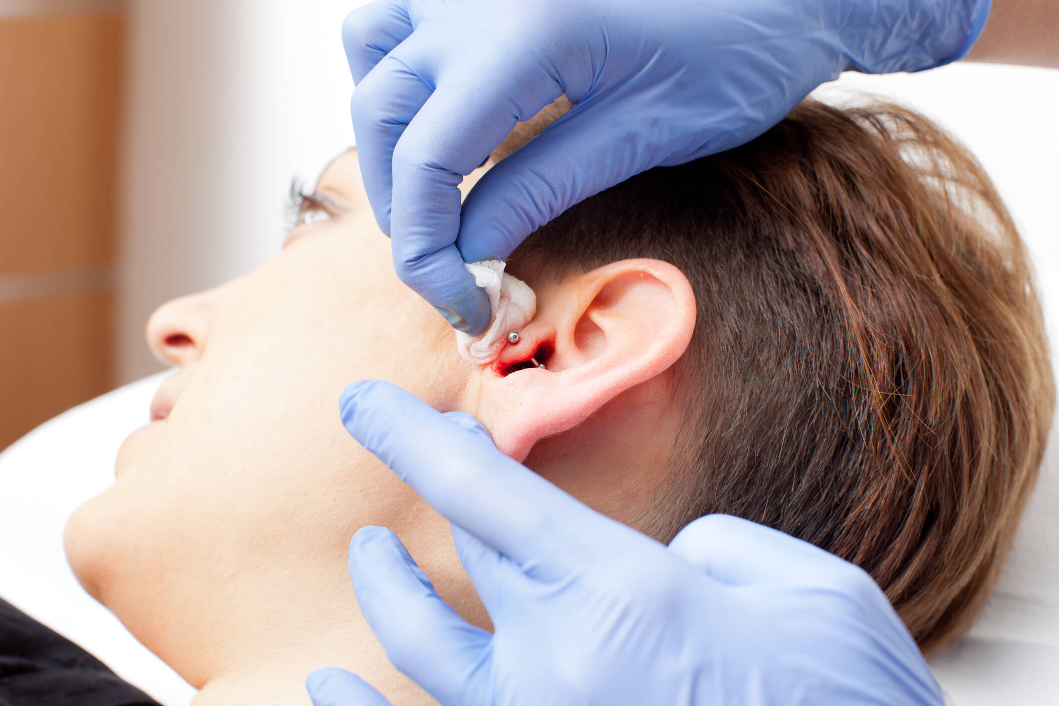 Intentó abrirse un piercing en la nariz en su casa y tuvo graves consecuencias: ‘Falle por completo’ Piercing
