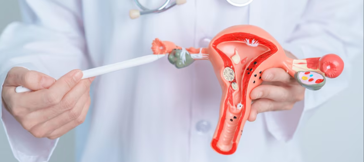 ¿Por qué comienza a doler la vagina entre los 40 y 50 años? ‘Es un problema hormonal que tiene remedio’ Cáncer cuello uterino