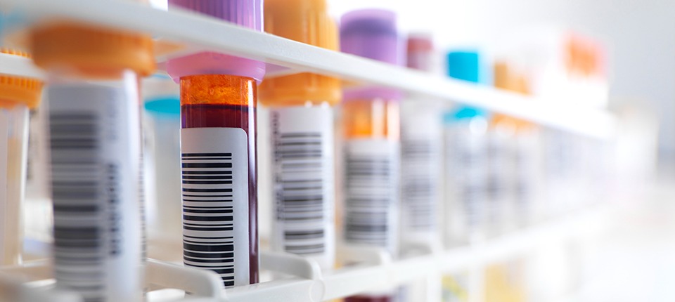 La ‘bacteria del recalentado’, uno de los riesgos de los platos navideños: así puede prevenirla y evitar enfermedades gastrointestinales en fin de año VIH