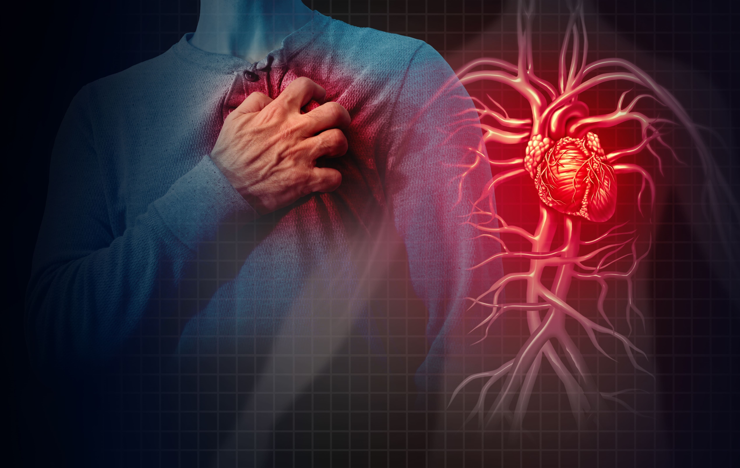 Los ejercicios más eficientes para bajar el colesterol, según la Clínica Mayo El elevado consumo de carbohidratos puede ocasionar un infarto.