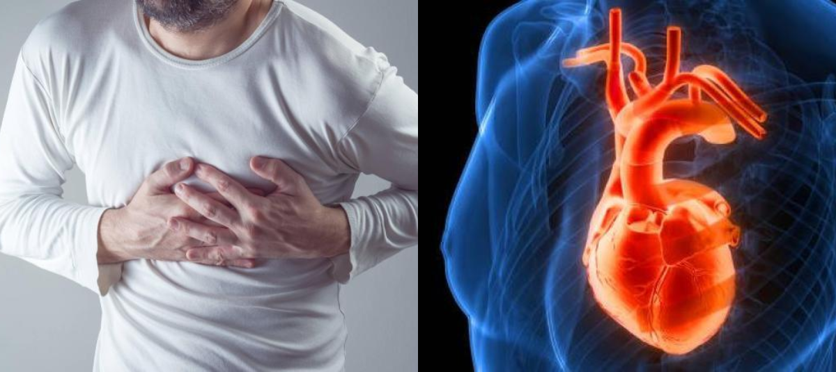 Los ejercicios más eficientes para bajar el colesterol, según la Clínica Mayo Cuatro factores de riesgo que causan casi todos los infartos y accidentes cerebrovasculares, según expertos