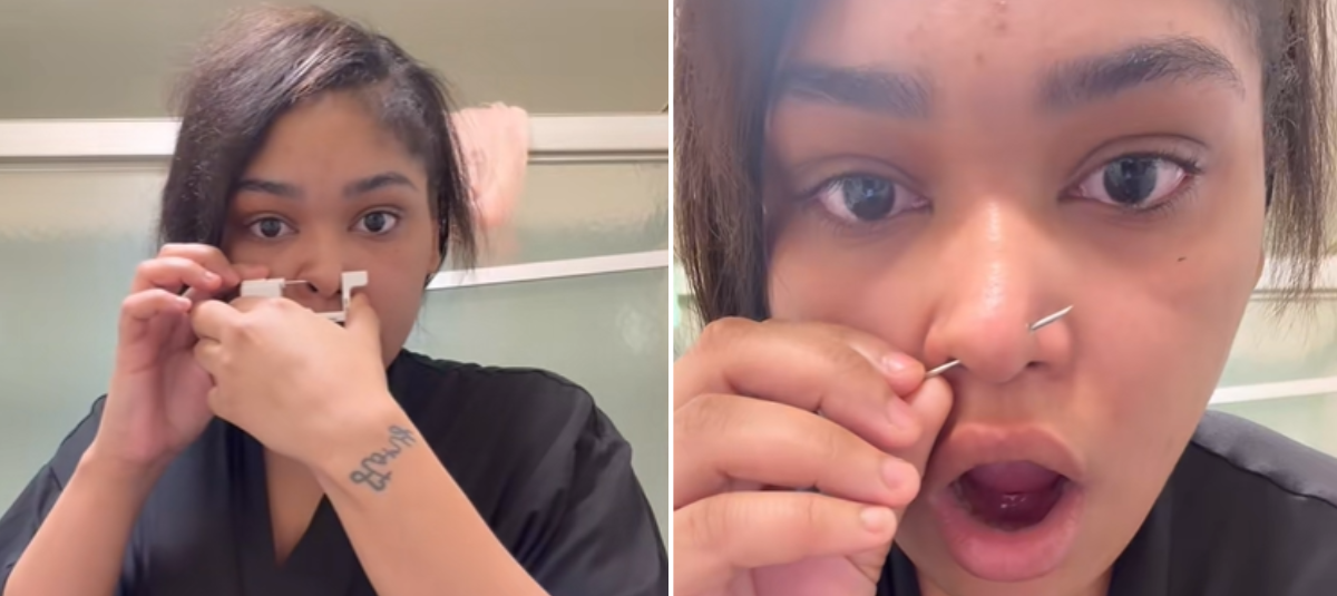 Estudiante de medicina se ofreció para una ecografía en clase y lo qué hallaron le salvó un riñón: 'Del tamaño de una pelota de ping pong' Mujer