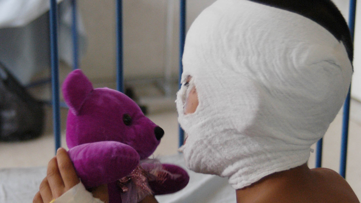 INS reporta 825 lesionados por pólvora en diciembre: un tercio son menores y no se registran muertes INS reporta 825 lesionados por pólvora en diciembre: un tercio son menores y no se registran muertes