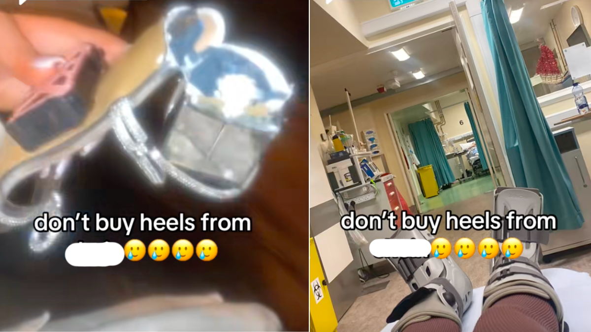 Joven se fracturó los talones al salir de fiesta: compró unos tacones nuevos por internet y se rompieron Joven se fracturó los talones al salir de fiesta: compró unos tacones nuevos por internet y se rompieron