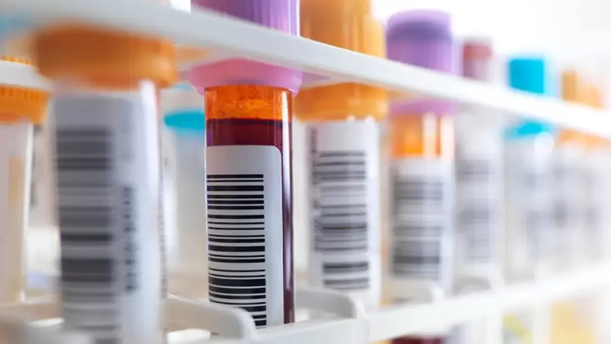 Vivir con VIH en Colombia: avances médicos amplían el horizonte de bienestar y calidad de vida Vivir con VIH en Colombia: avances médicos amplían el horizonte de bienestar y calidad de vida