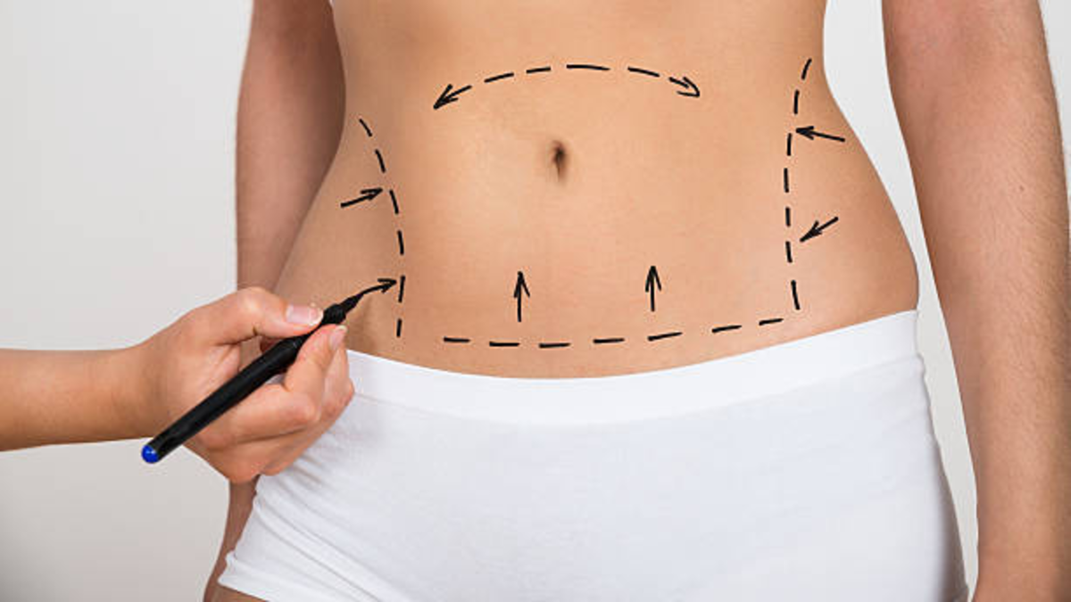 Pacientes internacionales impulsan el turismo médico en Colombia: estas son las intervenciones que más se realizan ¿A los 25, 35 o 45 años? Especialista aclara cuándo es el mejor momento para iniciar con procedimientos de medicina estética