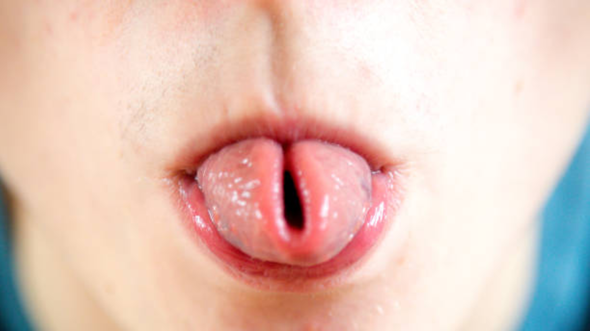 ¿Usted puede doblar la lengua en U? Genetistas descubren por qué algunas personas no ¿Usted puede doblar la lengua en U? Genetistas descubren por qué algunas personas no