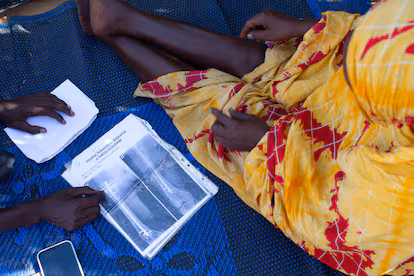 Los recortes de ayuda humanitaria ahogan a cientos de miles de desplazados sudaneses: “Antes teníamos 100 sacos de arroz para 2.000 personas, ahora solo tenemos 20” Khadija Haroun muestra las radiografías de su pierna, donde se distinguen siete clavos y una barra metálica que debían habérsele retirado hace seis meses, en su casa del campo de refugiados de Farchana, en el este de Chad, en diciembre de 2025.