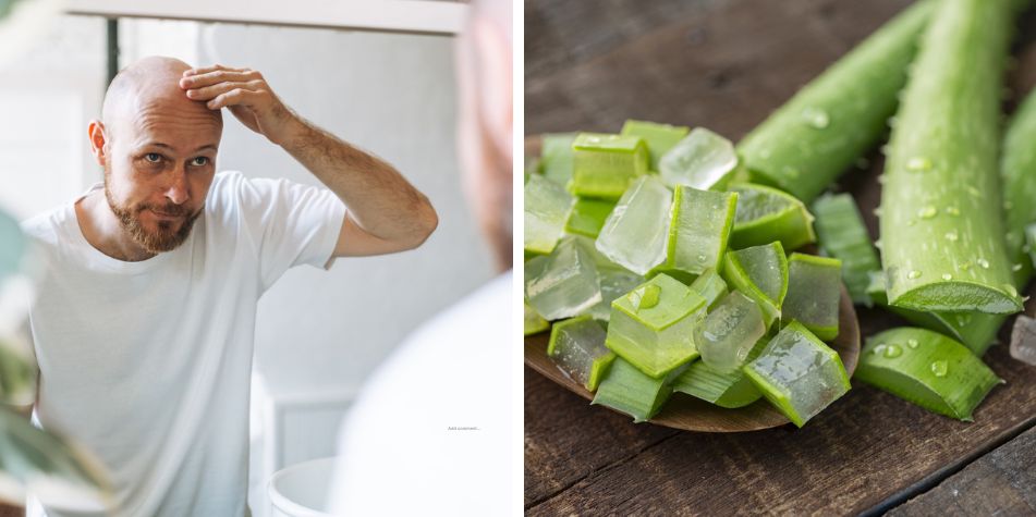 ¿Por qué el cabello se comienza a caer desde arriba, según expertos? Tiene un alto contenido de vitaminas A, C, E y B12.