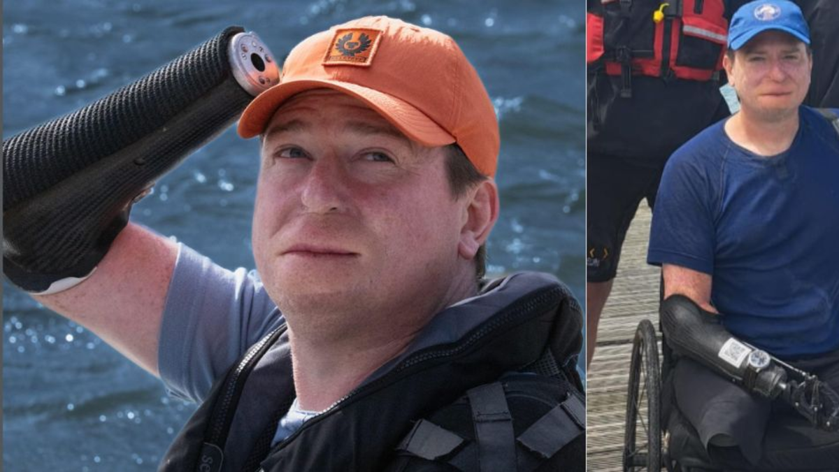 Confundió los síntomas de la gripa con mortal bacteria y le amputaron todas sus extremidades Confundió los síntomas de la gripa con mortal bacteria y le amputaron todas sus extremidades