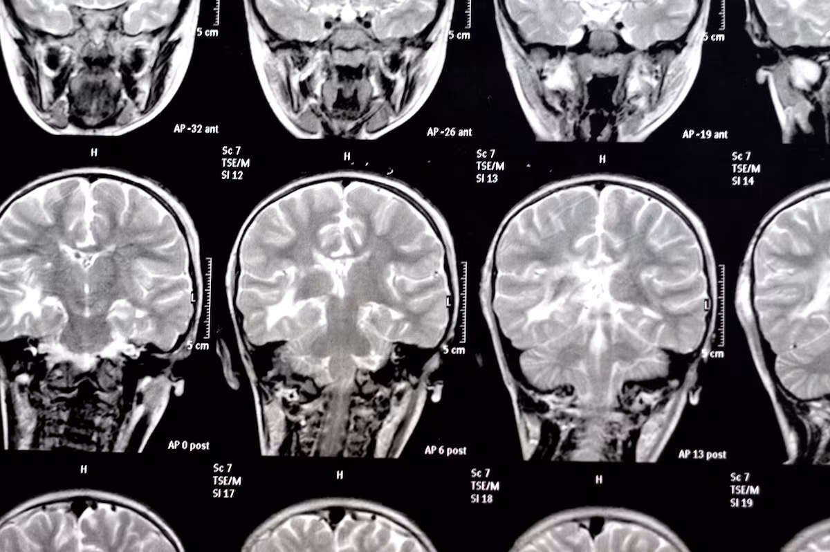 From Borges to Jennifer Aniston: Science begins to illuminate the mysteries of memory EL PAÍS