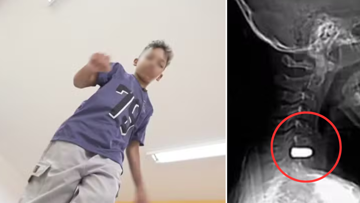 El niño que recibió una bala perdida y sorprendió a los médicos al volver a caminar pese a tener el proyectil en su columna: 'Gracias por orar' El niño que recibió una bala perdida y sorprendió a los médicos al volver a caminar pese a tener el proyectil en su columna: 'Gracias por orar'