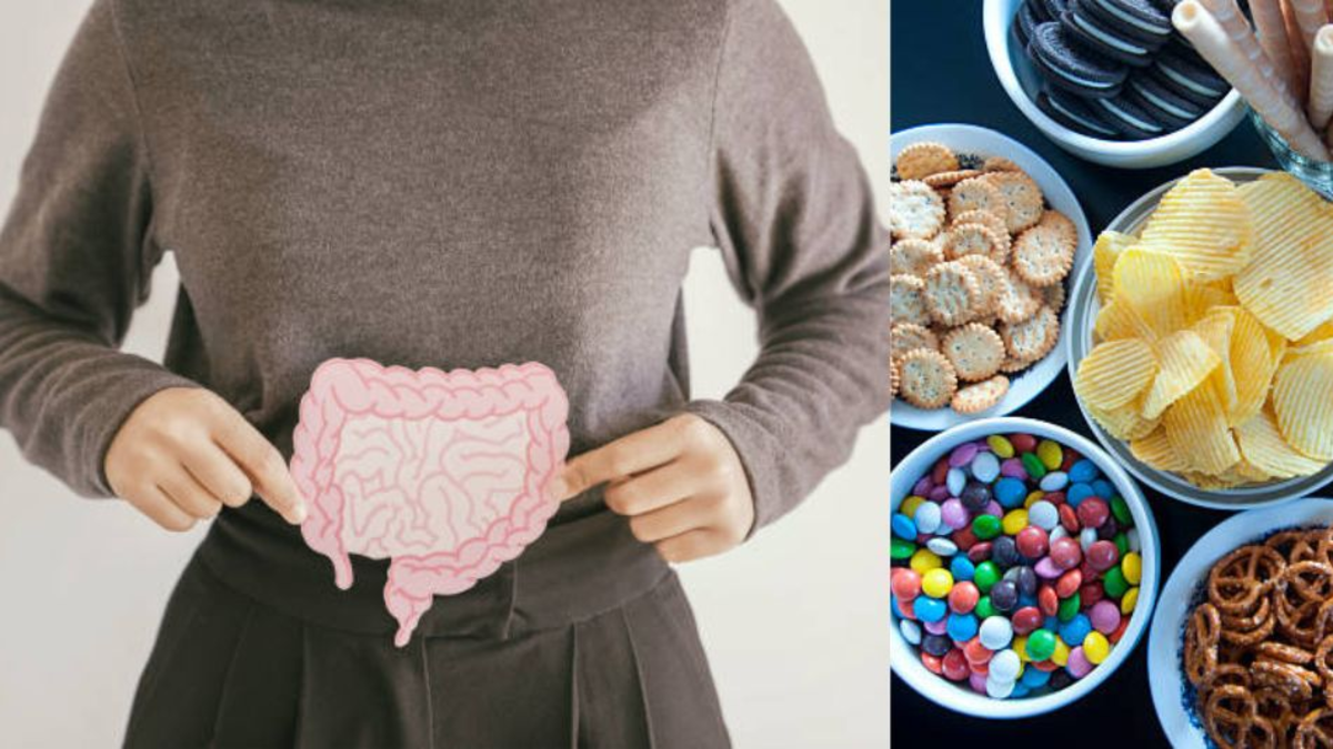 Estos son algunos alimentos que pueden afectar la salud intestinal, según los expertos Estos son algunos alimentos que pueden afectar la salud intestinal, según los expertos