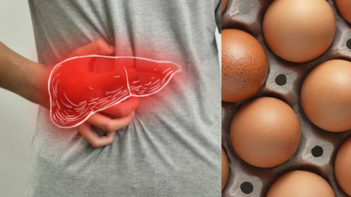 Hígado graso: cuántos huevos se pueden consumir por semana según expertos en nutrición Hígado graso: cuántos huevos se pueden consumir por semana según expertos en nutrición