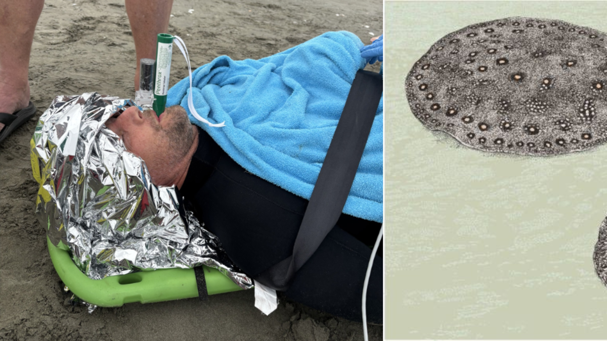 Hombre se salva de milagro tras el ataque de una raya durante un entrenamiento de rescate: ‘Lo apuñaló en el abdomen’ Hombre se salva de milagro tras el ataque de una raya durante un entrenamiento de rescate: ‘Lo apuñaló en el abdomen’