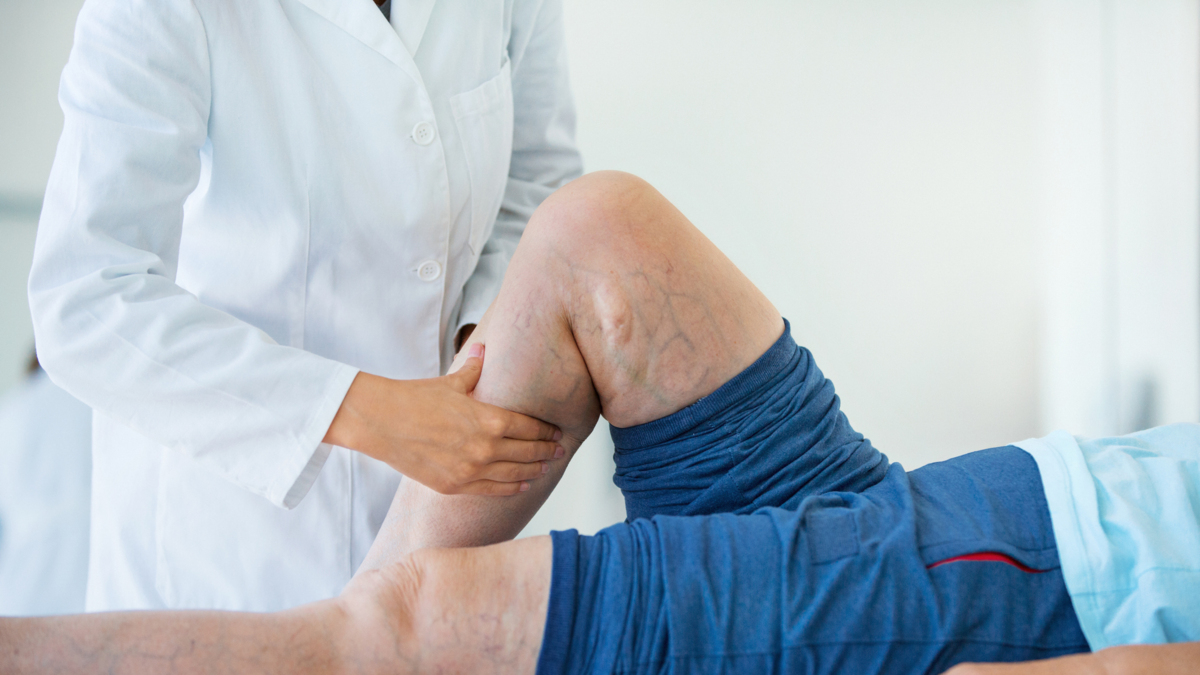 Método Ardila: seis claves para mejorar la calidad de vida de pacientes con linfedema Método Ardila: seis claves para mejorar la calidad de vida de pacientes con linfedema