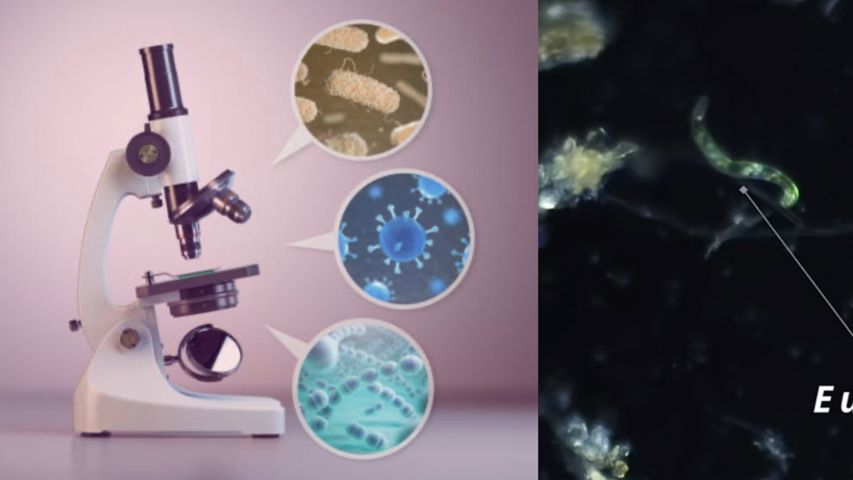 Microbiólogo mostró todo lo que se puede encontrar en un charco de Bogotá Microbiólogo mostró todo lo que se puede encontrar en un charco de Bogotá