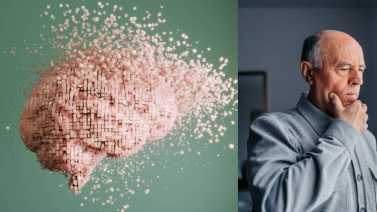 No toda pérdida de memoria indica Alzheimer: neurólogo explicó las diferencias No toda pérdida de memoria indica Alzheimer: neurólogo explicó las diferencias